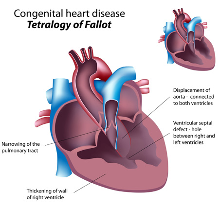 Normal Heart Diagram
