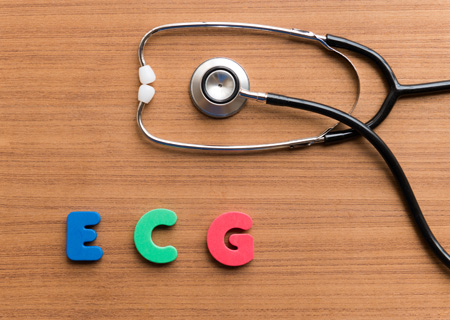 ECG Test